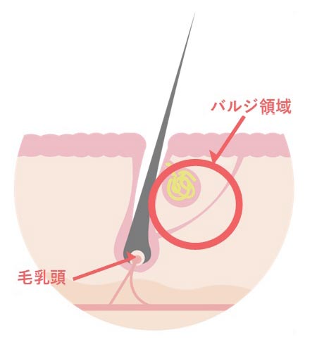 ボナチュールの美肌脱毛