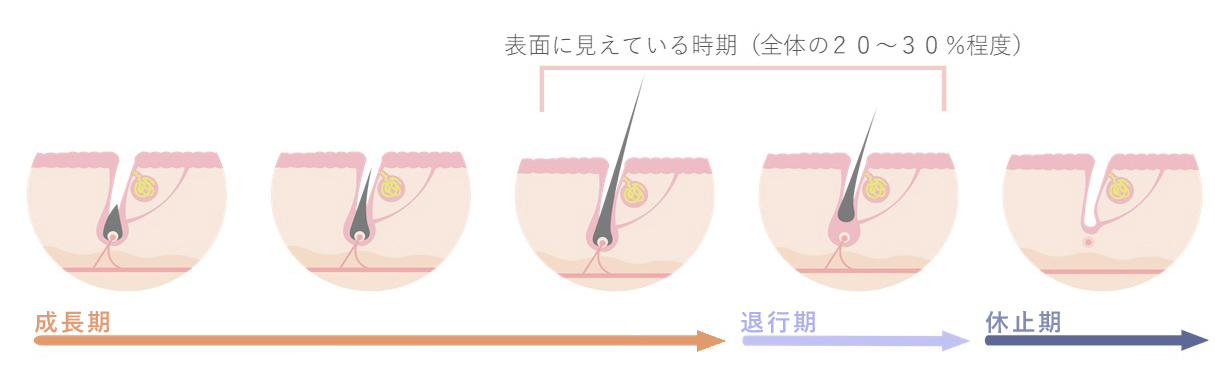 ボナチュールの美肌脱毛
